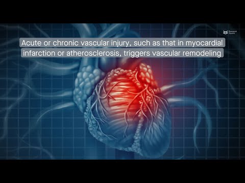 ATP purinergic signaling drives vascular remodeling mediated by Sca-1⁺ stem cells